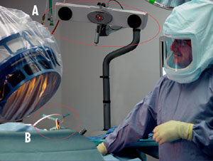 Fluoro Computer-Assisted Knee Replacement Surgery