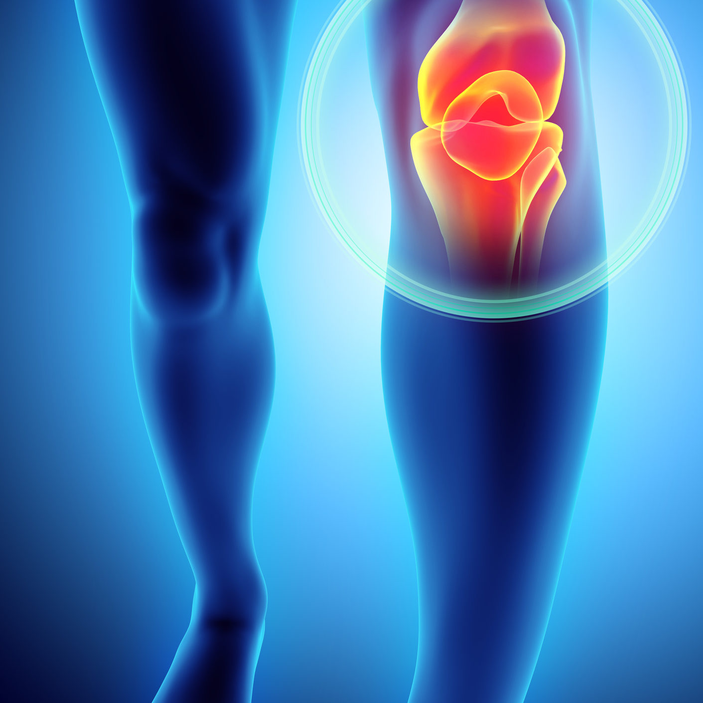 Knee Pain Treatment In Redding