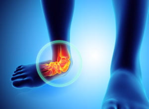 Ankle Pain Treatment In Redding