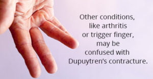 Dupuytren's Contracture In Redding