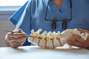 Image of spine doctor using spine to show Degenerative Disc Disease