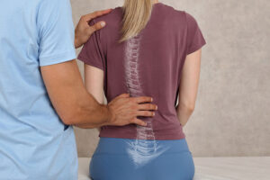woman with scoliosis, spinal deformities treatment in Redding. 