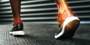 Foot Doctors Can Help Revise Total Ankle Replacement